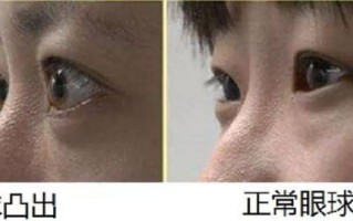 为什么眼镜离脸太近，为什么眼镜离脸太近看不清