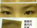 镜眼距离过近怎么样，镜眼距离过近怎么样矫正