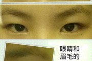 镜眼距离过近怎么样，镜眼距离过近怎么样矫正