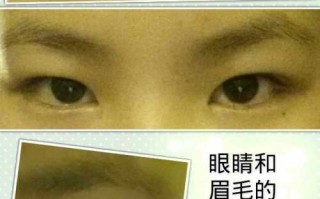 镜眼距离过近怎么样，镜眼距离过近怎么样矫正