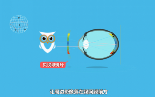 如何保护镜片，如何保护镜片及保养