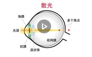 怎么知道眼睛散光，怎么知道眼睛散光不散光