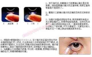 隐形如何分辨正反面，隐形如何分辨正反面图片