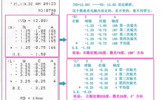 眼镜店度数怎么看，眼镜店的度数怎么看